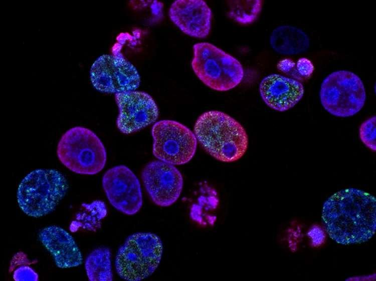 Here’s what to know.